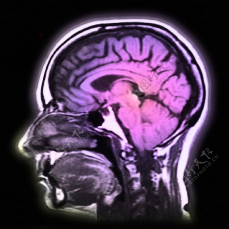 科学技术医疗大脑图层医疗图片