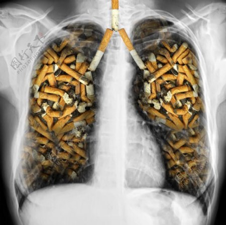 吸烟者的肺图片