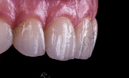 口腔牙齿结构