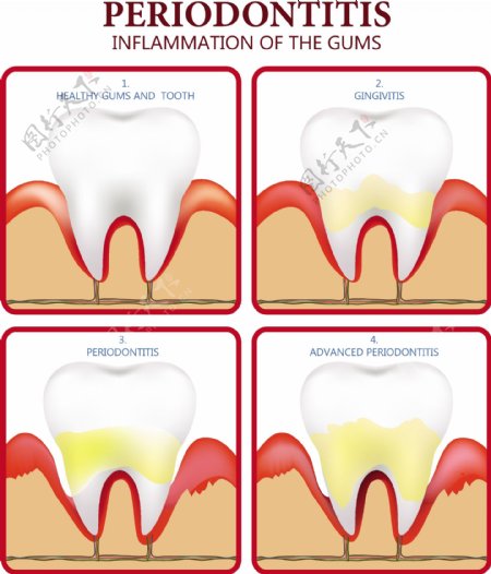 牙周病海报平面彩色设计齿图标免费矢量