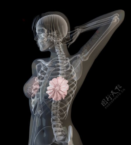 女性X光透视图图片