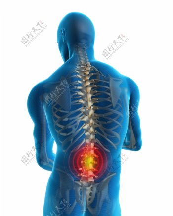 脊髓腰部疼痛图片