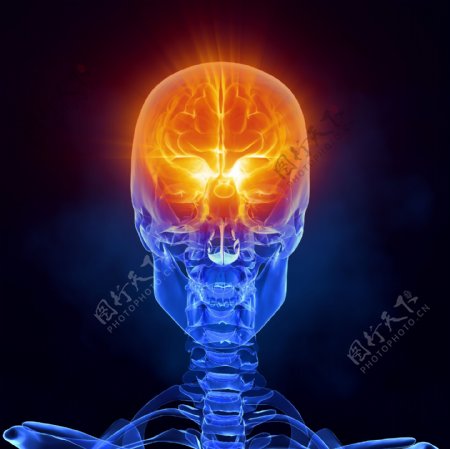 男性头骨CT图片