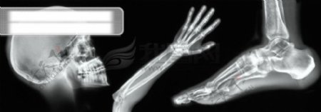 医学透视人体骨骼探索研究全方位平面设计素材辞典