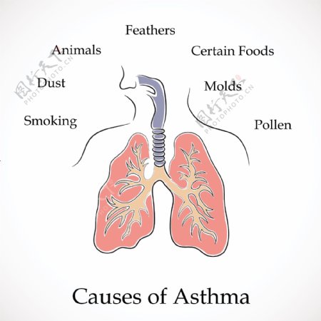 哮喘矢量世界哮喘日的原因