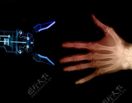 机械手和人手的X光照图片