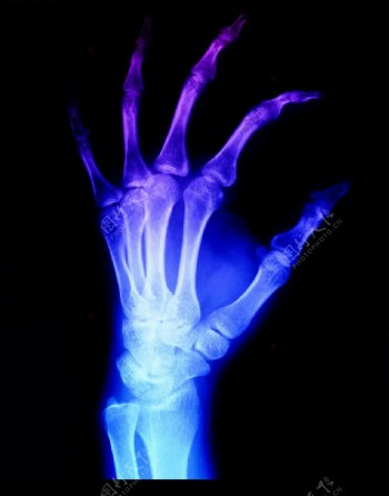 X光手骨医疗科技卫生图片