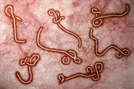 显微镜下的埃博拉病毒图片
