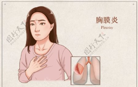 胸膜炎疾病健康卫生背景素材图片